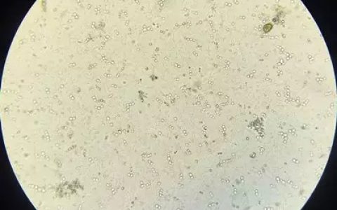 乳酸菌在水产养殖中的七大功效，解毒促生长，广谱抗菌生态灭弧菌