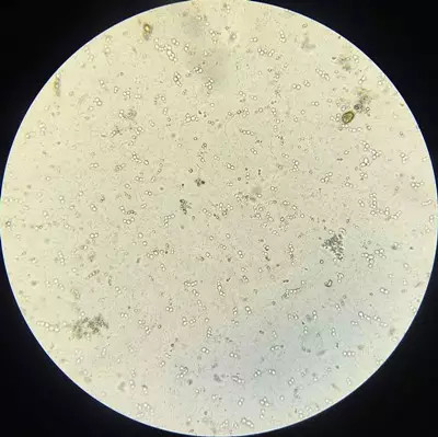 乳酸杆菌大量图片