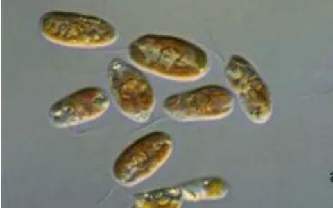 隐藻——鱼虾塘水产养殖中的特殊藻类，鲢鳙鱼好饲料